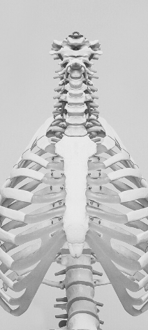 Edema osseo vertebrale
